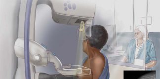 Más de 14.400 mujeres han participado este año en el Programa de Detección Precoz del Cáncer de Mama en Baleares