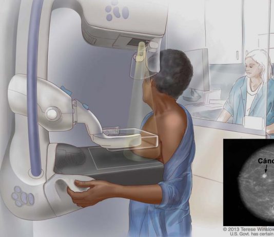 Detectados 6.130 nuevos casos de cáncer en Baleares durante 2021