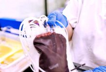 Sangre de cordón umbilical donada en el Hospital de Can Misses será utilizada en un trasplante de médula ósea Donaciones sangre cordón umbilical